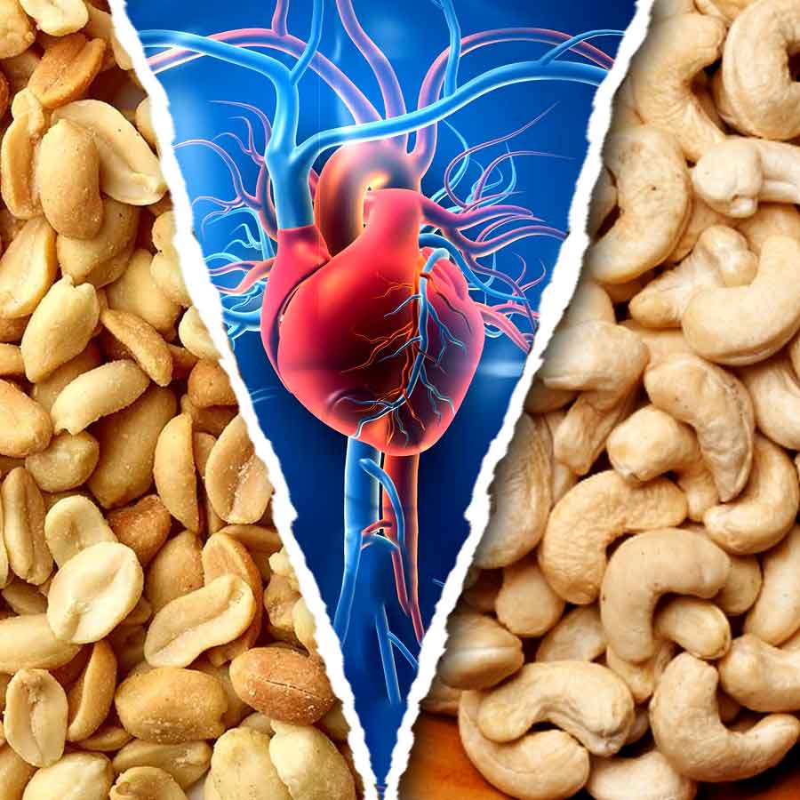 কাজুবাদাম কি কোলেস্টেরল বাড়িয়ে দেয়?