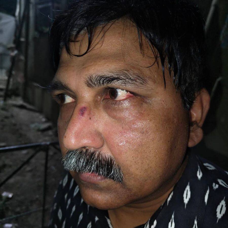 অধ্যাপক রাজ্যেশ্বর সিংহ ছাত্রের কাছে মার খাওয়ার পর।