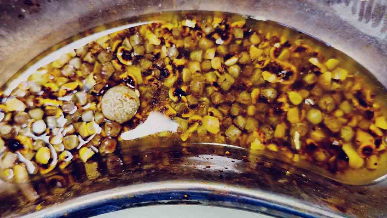 অস্ত্রোপচার করে বের করা পাথর।