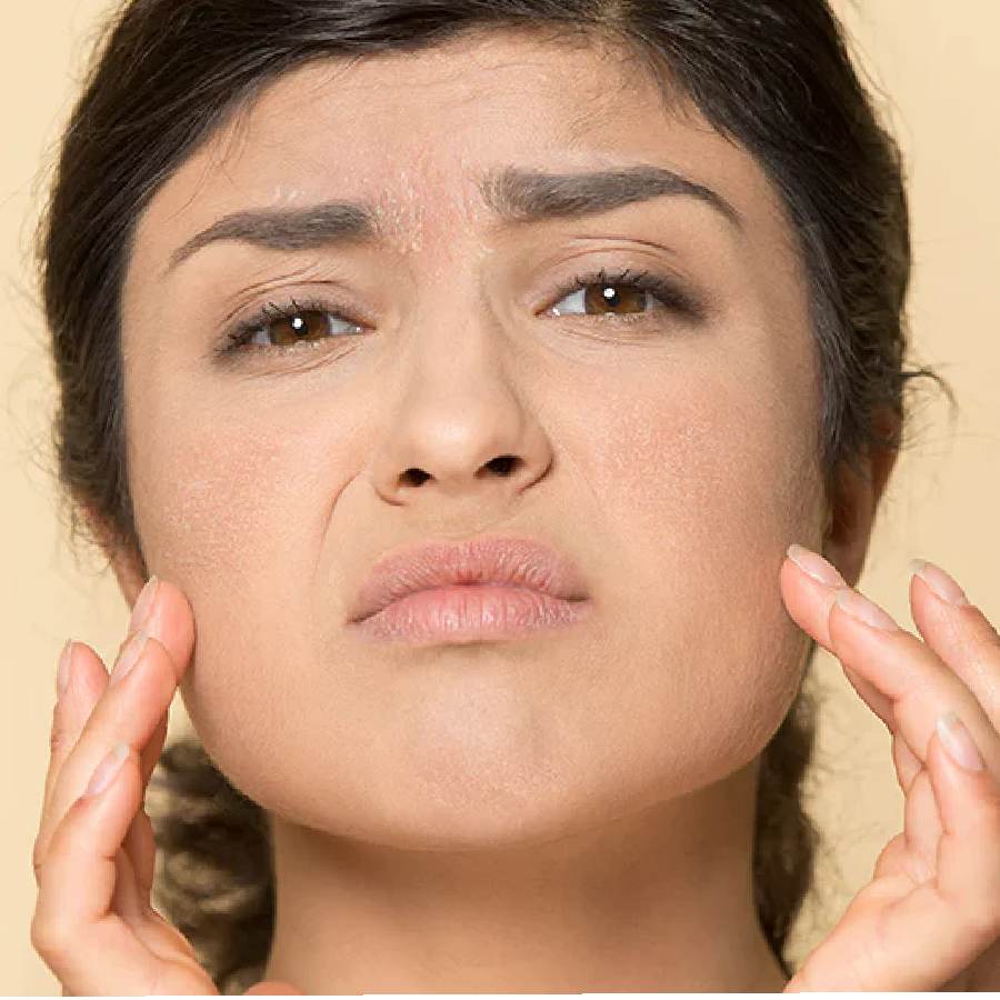 Make homemade hydrated mask for excessively dry skin