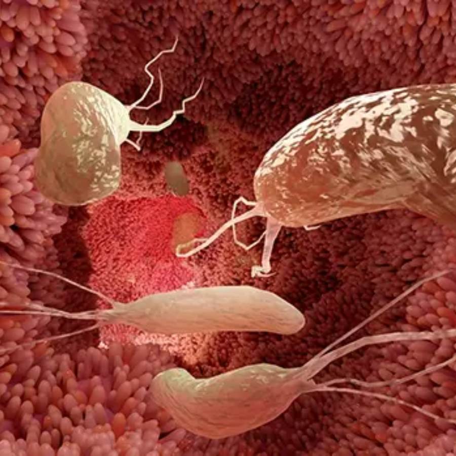 ব্যাক্টেরিয়ার সংক্রমণের ঝুঁকি পেটে।