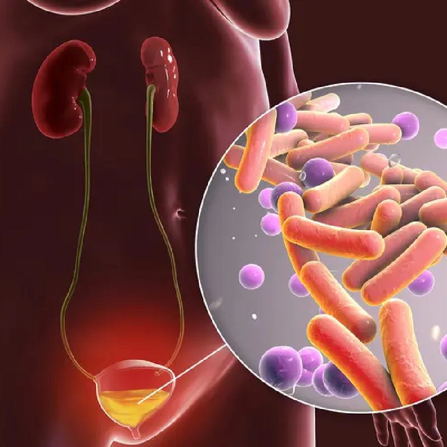 Sings of urinary tract infection and what to do with this