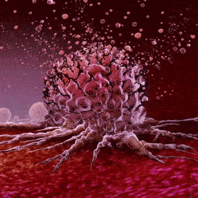 Blocking a certain protein can slow cancer cells growth, new study says