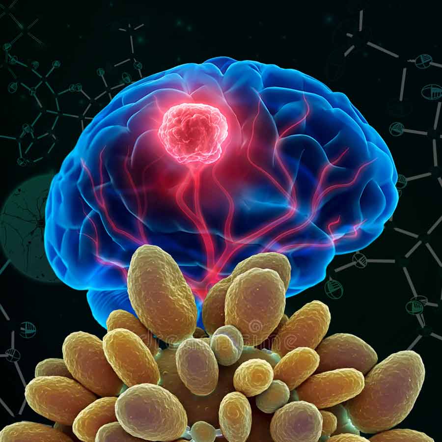 The fungal compound verticillin A, discovered can destroy cancer cells