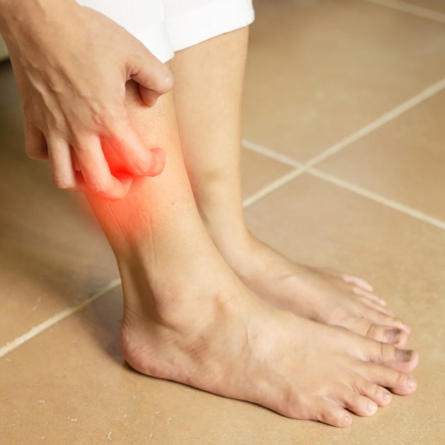 what should do if you are experiencing winter leg rash dgtl