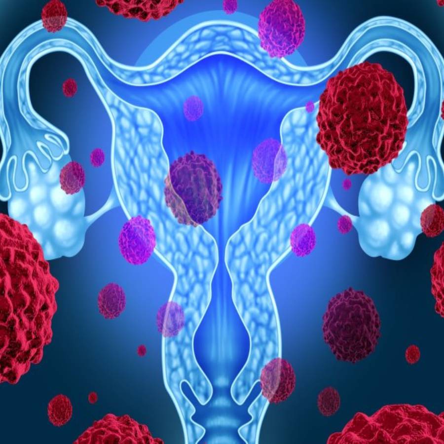 জরায়ুমুখের ক্যানসারের ঝুঁকি কমবে টিকায়।