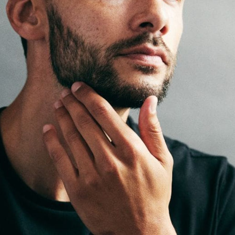 A kiss can cause skin rash due to partner’s beard dgtl