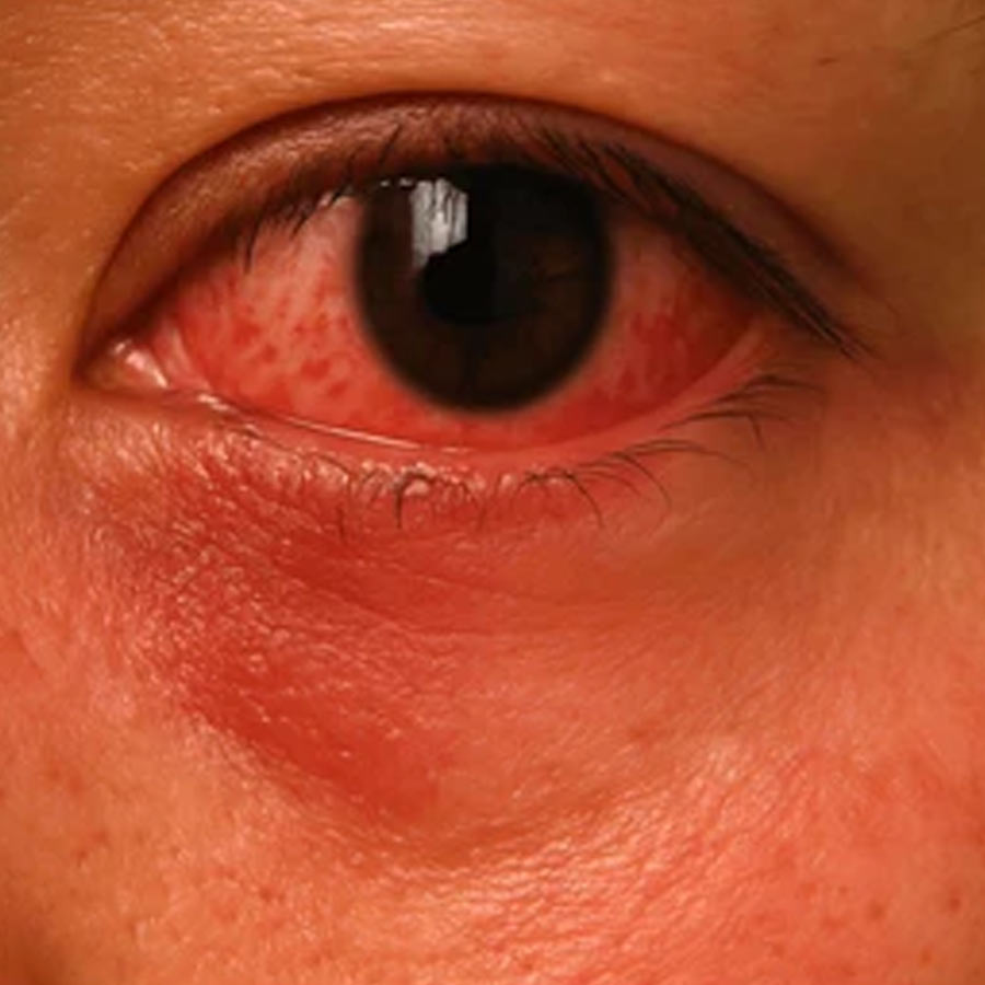 India's Sleepless man