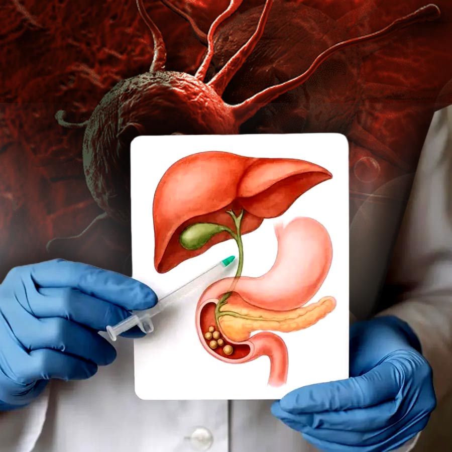 পিত্তথলির ক্যানসারের ঝুঁকি।