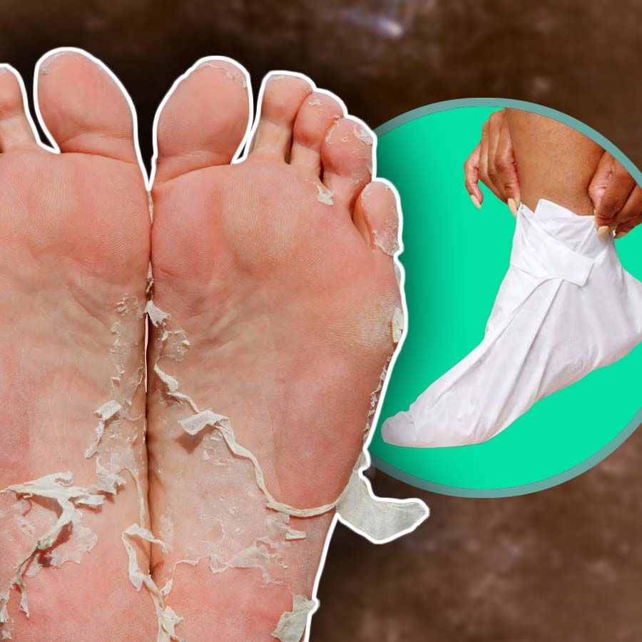 ফুট পিলিং মাস্ক কি সত্যিই কাজের?