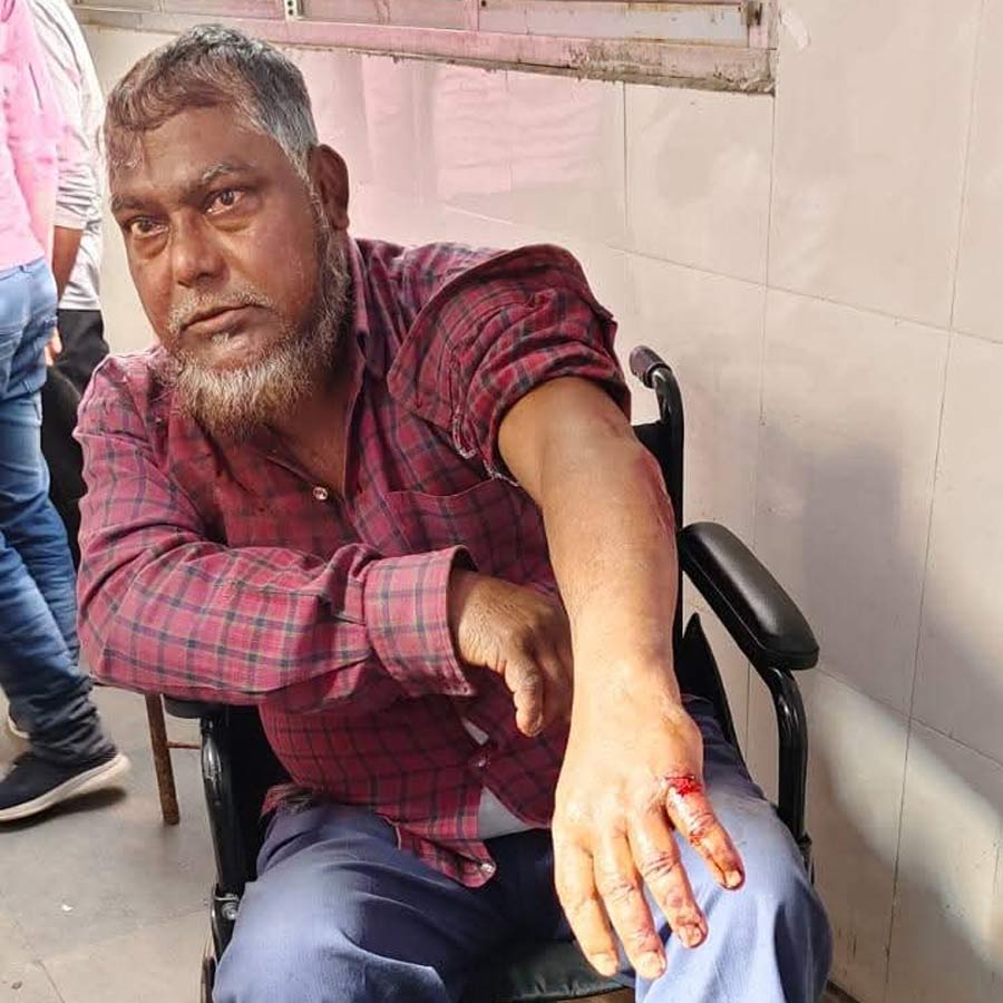 আহত পুঁটিমারি ফুলেশ্বরী গ্রাম পঞ্চায়েতের উপপ্রধান।