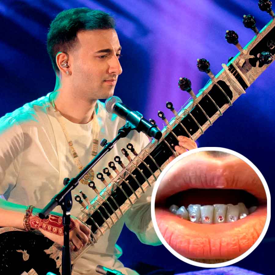 ঋষভের দাঁতসজ্জায় যখন হিরে।