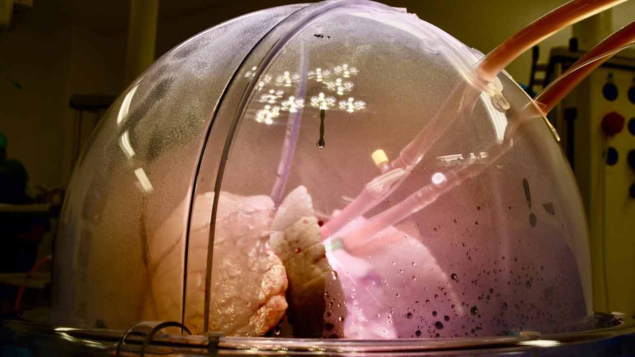 Indian doctor invent Artificial Lung system to keep patient alive for 48 hours