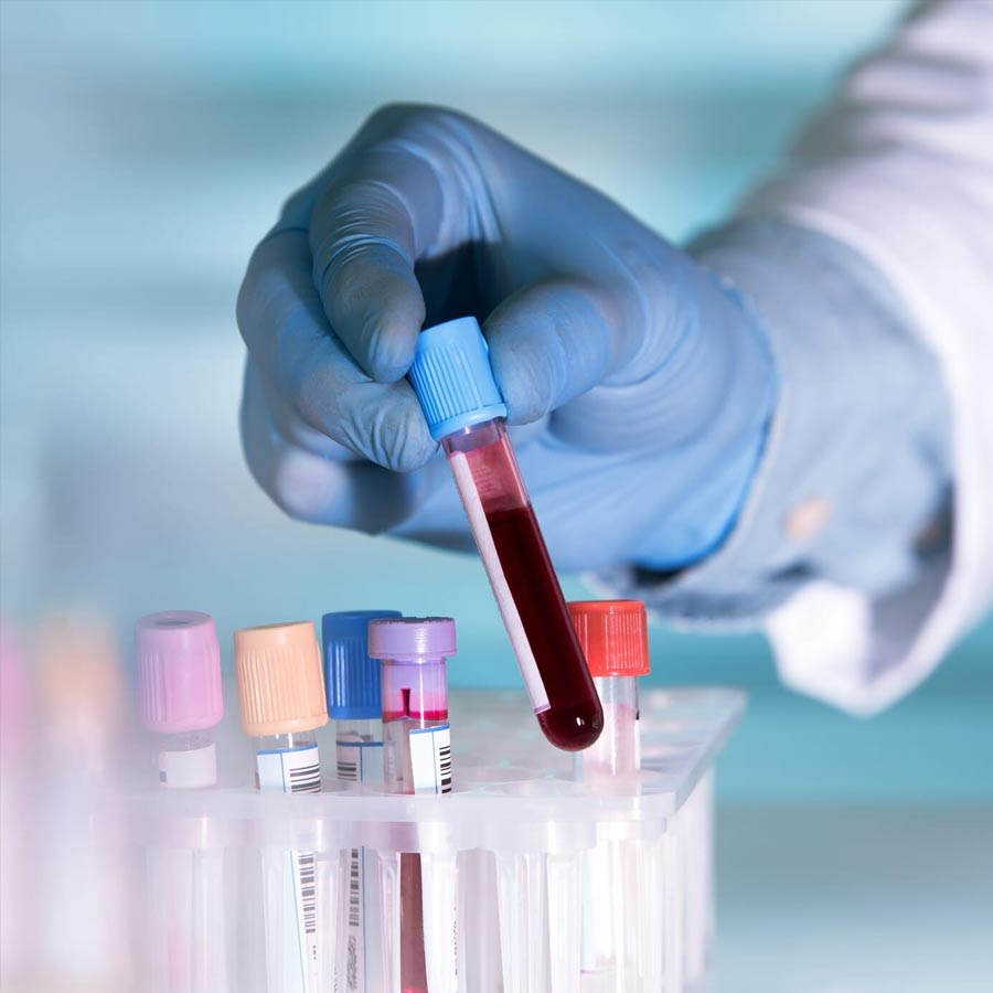 Single Blood Test to Screen for Ten Common Cancers Set for India Rollout