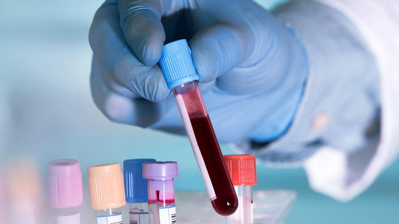 Single Blood Test to Screen for Ten Common Cancers Set for India Rollout