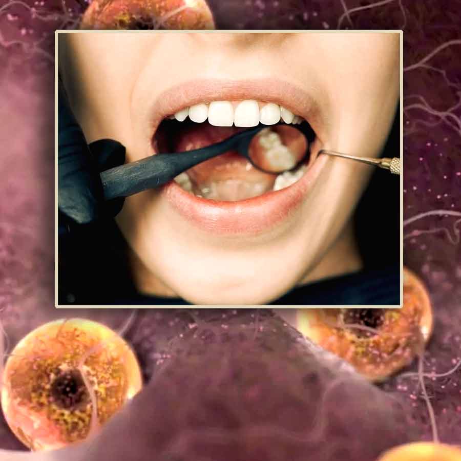 From Mouth to Ovary, the hidden link between Dental Infections and Infertility