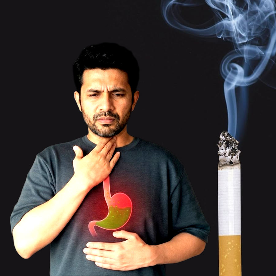 Why That Post-Cigarette acid Burn is more than just common Acidity