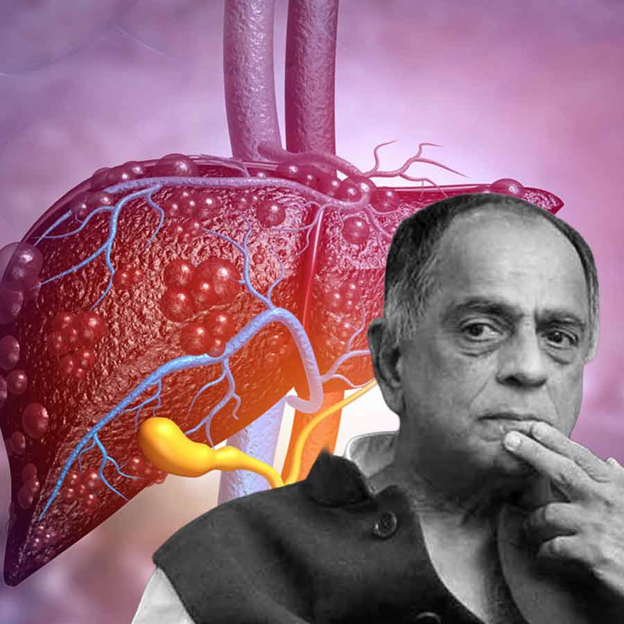 লিভার সিরোসিসে ভুগছিলেন প্রয়াত পহলাজ নিহলানী।