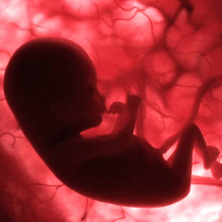 For first time, scientists precisely edit human embryo genes