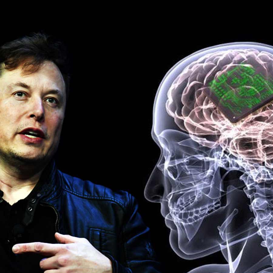 World’s First Approved Brain-Computer Interface Set to Challenge Elon Musk’s Neuralink