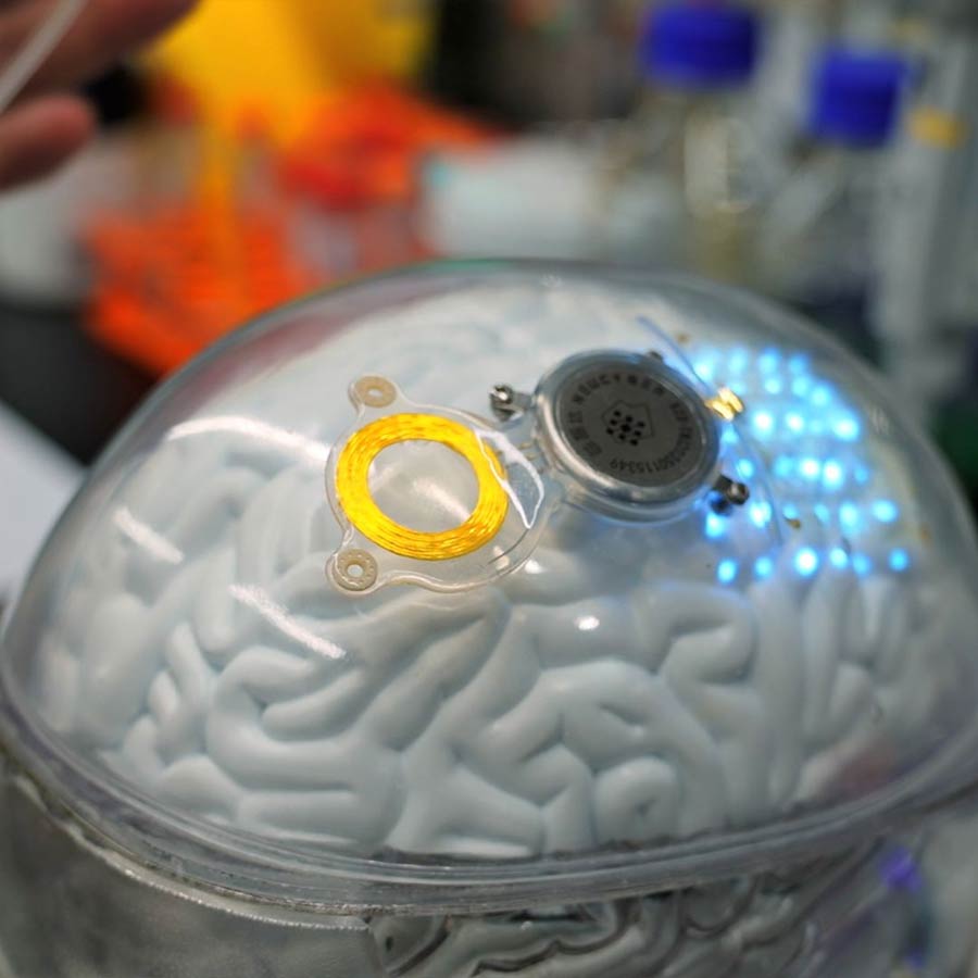 World’s First Approved Brain-Computer Interface Set to Challenge Elon Musk’s Neuralink