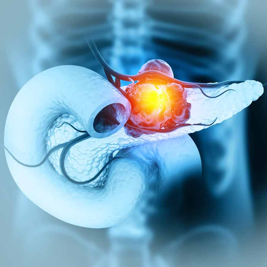 Signs that indicate your pancreas not working properly