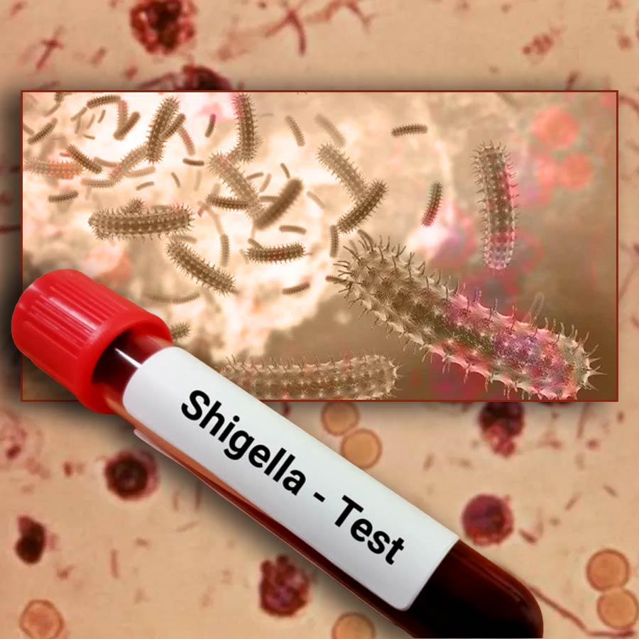 Shigella alert in Kerala, all you need to know about this deadly bacterial infection
