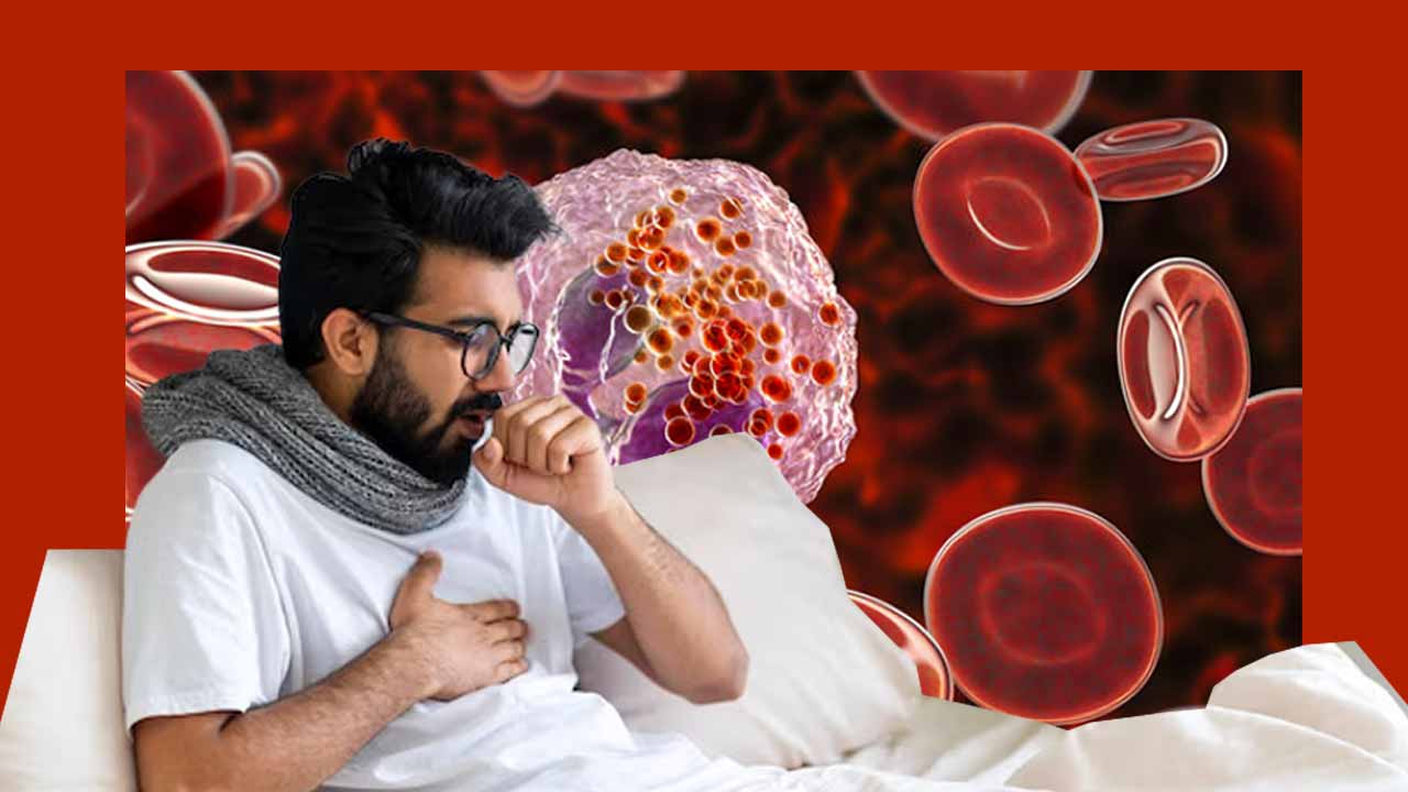 What is Eosinophilia, what are the symptoms and prevention tips