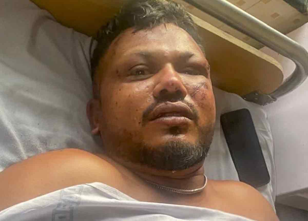 এই বিমান দুর্ঘটনায় যাত্রী, বিমানকর্মী-সহ মৃত্যু হয়েছিল মোট ২৬০ জনের। অবিশ্বাস্য ভাবে বেঁচে গিয়েছিলেন এক জন, ব্রিটিশ নাগরিক বিশ্বাসকুমার রমেশ। দুর্ঘটনাগ্রস্ত বিমানের ১১এ আসনে বসেছিলেন তিনি। দুর্ঘটনার পর বিমানের ধ্বংসস্তূপের কাছ থেকে বেরিয়ে হেঁটে হেঁটেই অ্যাম্বুল্যান্সে উঠতে দেখা গিয়েছিল রমেশকে। কী ভাবে বেঁচে গেলেন, তা নিজেও বলতে পারেননি রমেশ। এক বছরে শরীরের ক্ষত অনেকটা মিলিয়ে গেলেও আতঙ্ক এখনও পুরোপুরি কাটেনি রমেশের।