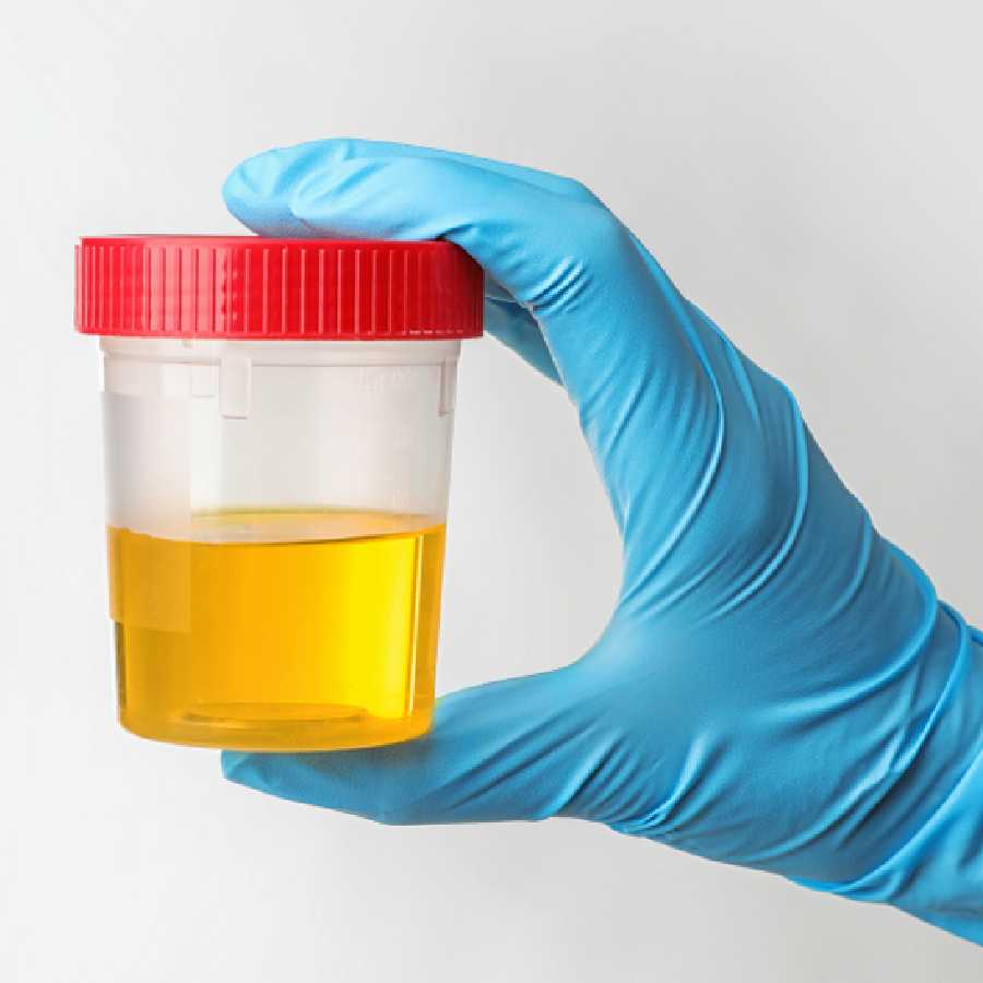 Tips women should keep in mind while giving urine sample for testing dgtl