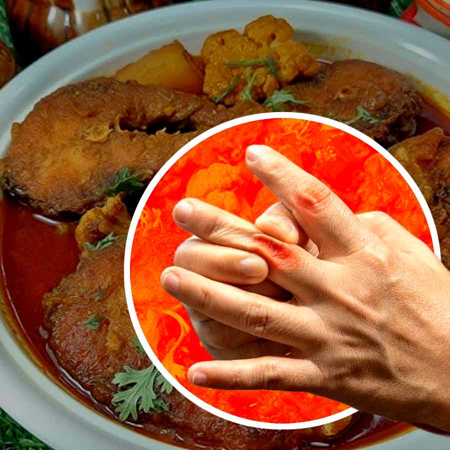 Is eating Ruhu and Katla fish can cause high level of Uric acid in your blood dgtl