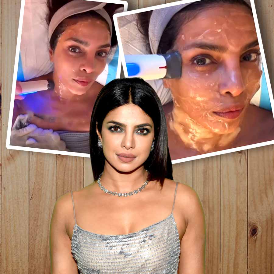 What is xerf skin treatment that Priyanka Chopra is trying dgtl