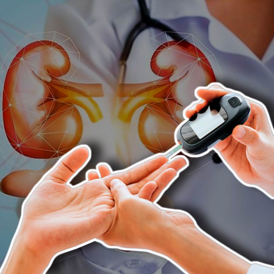 5 Kidney Disease Symptoms Every Diabetes Patient Should Know