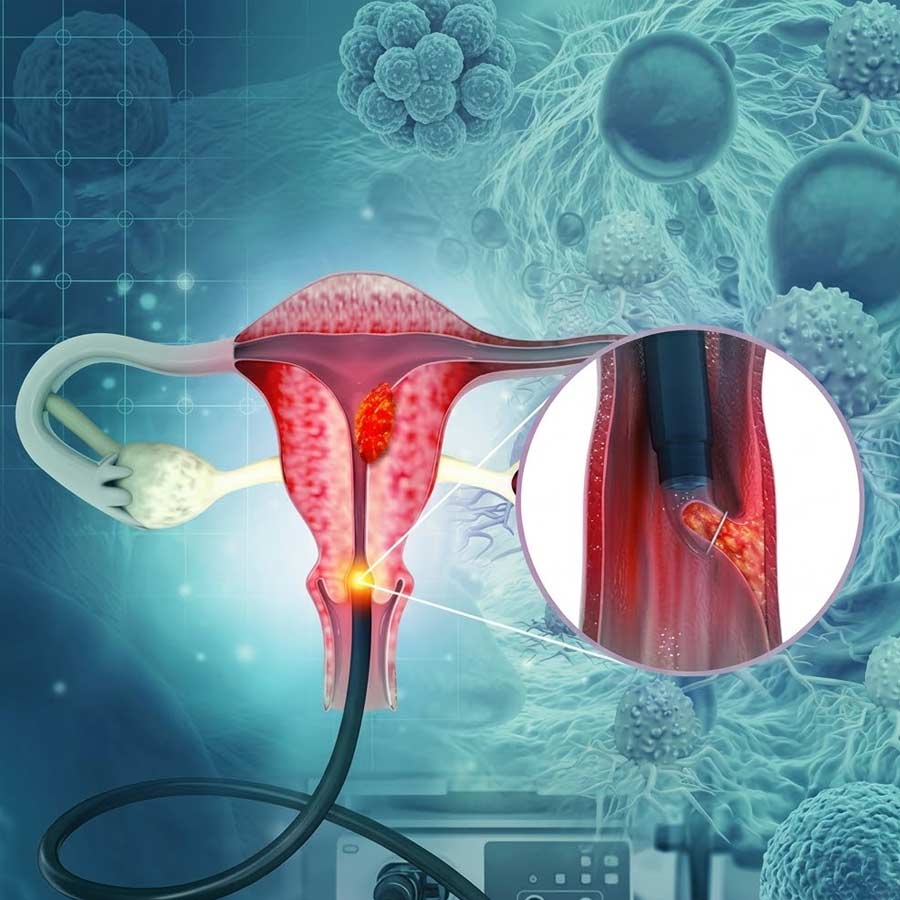 Researchers have validated India\\\\\\\'s first homegrown HPV test