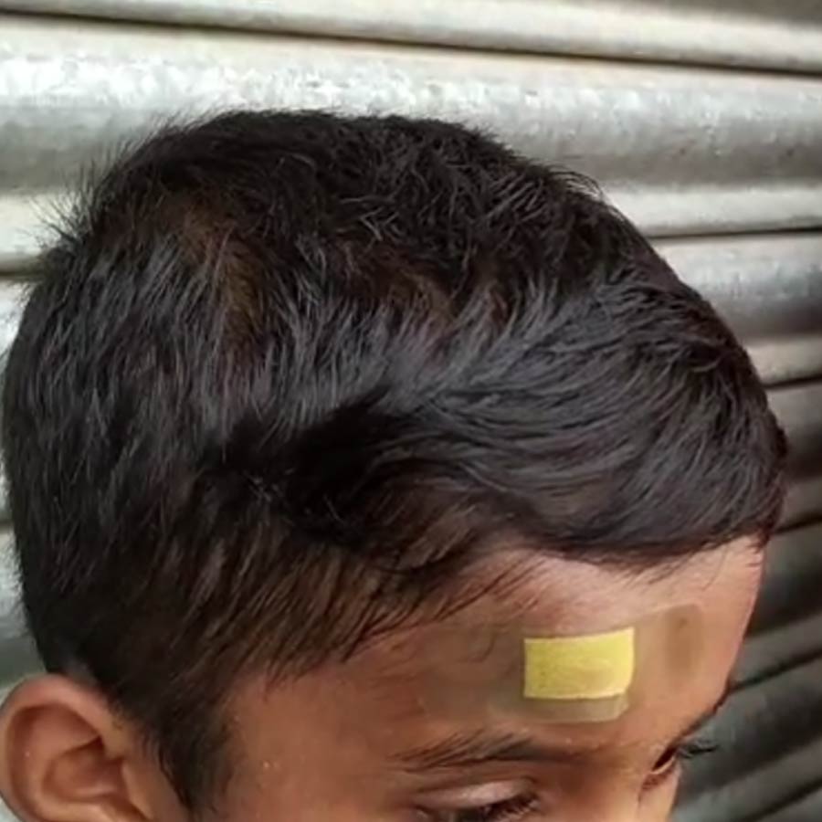 Student allegedly beaten by school staff in Nadia, over Mid Day Meal dgtl