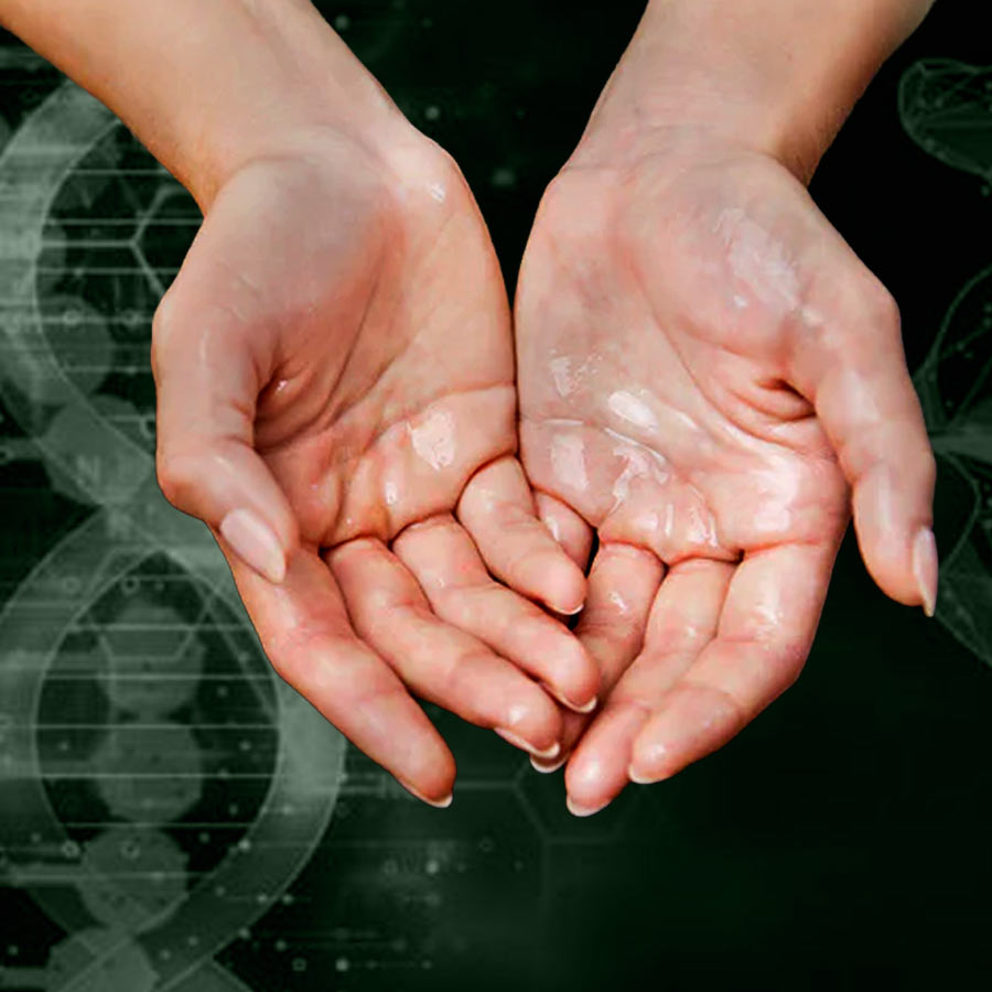 What is Palmar Hyperhidrosis, why your hands sweat uncontrollably and how to stop it