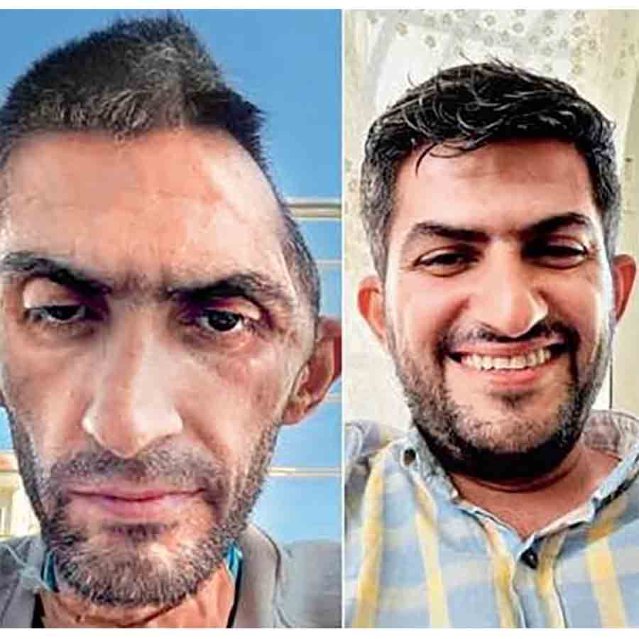 Palestine journalist shared his photos of before and after detention in Israel
