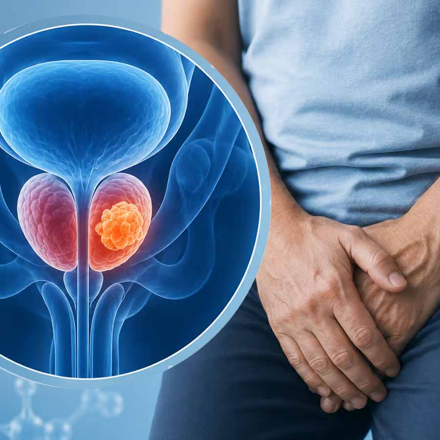India Welcomes Its First Targeted Radioligand Therapy for Prostate Cancer dgtl