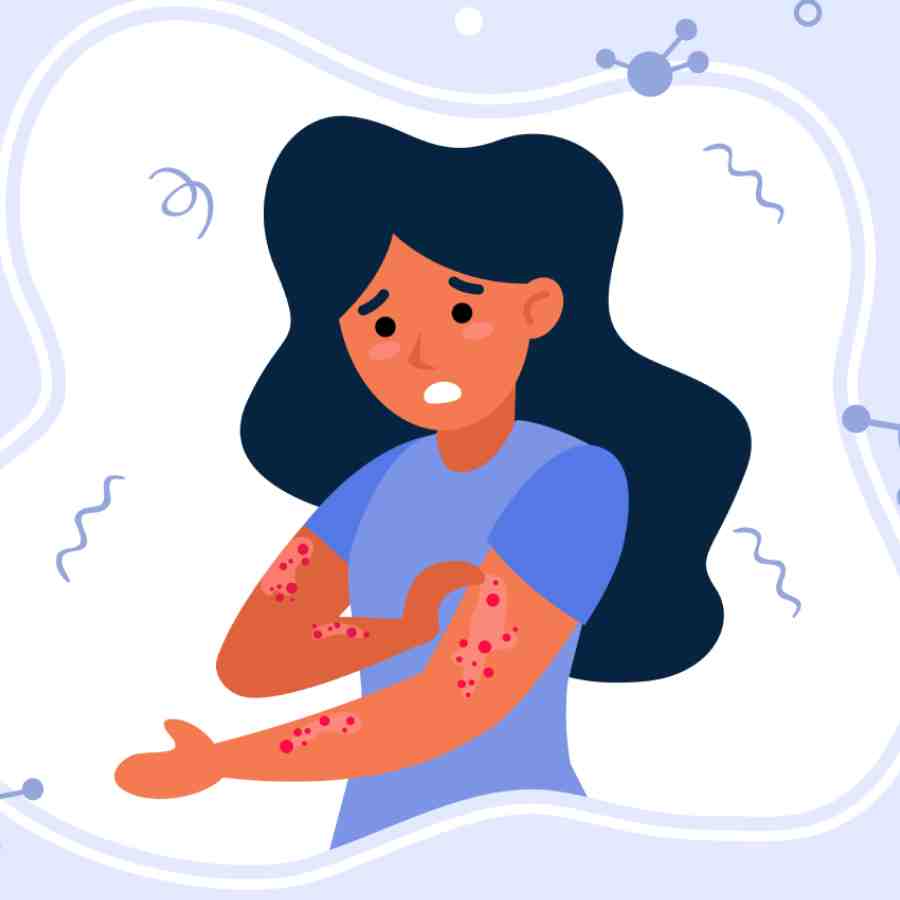 Are Your Makeup or Your Diet Causing skin rashes, expert Tips Home Remedies for Clear Skin