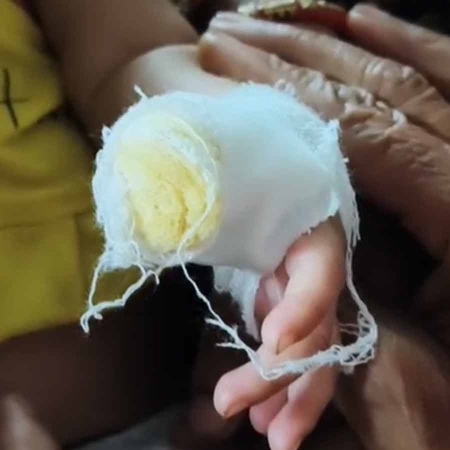 Ward Boy of Malda’s Hospital allegedly cut finger of a minor patient sparks controversy dgtld