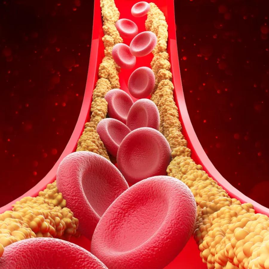 নিয়ন্ত্রণে রাখুন কোলেস্টেরল।