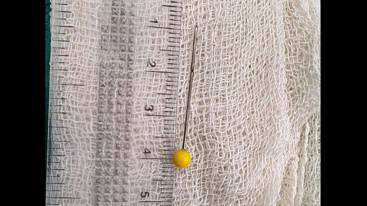 কিশোরীর শ্বাসনালিতে আটকে থাকা সেই পিন। নিজস্ব চিত্র।