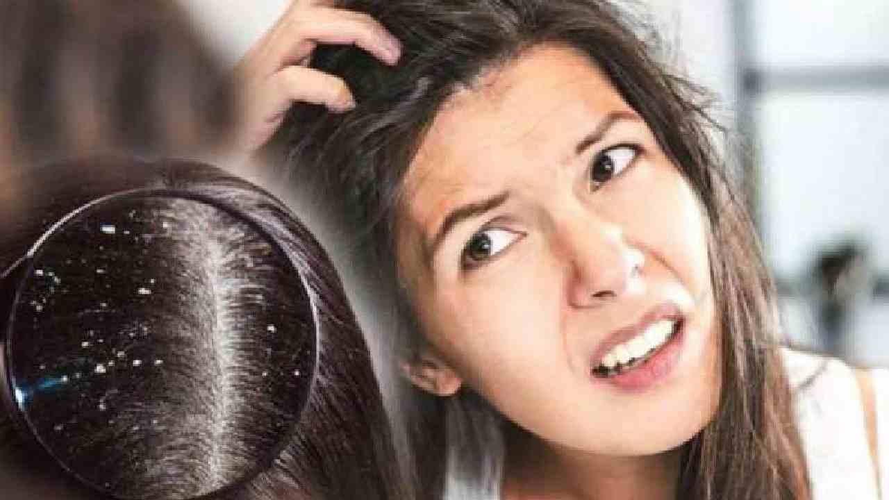 খুশকি কমবে নিমের জাদুতে।