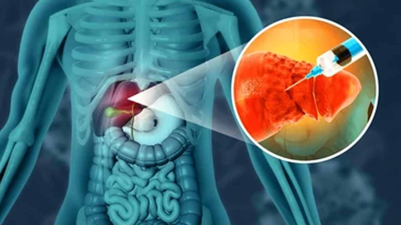 Scientists have developed tiny engineered satellite livers that can be injected into the body to support liver function