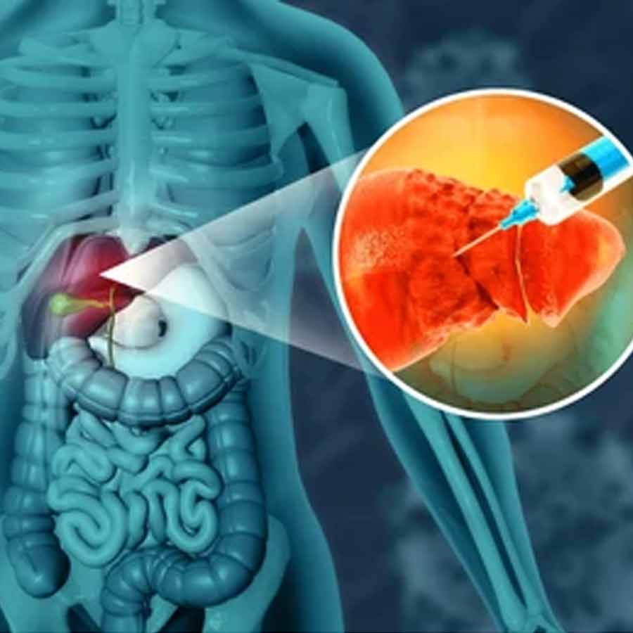 Scientists have developed tiny engineered satellite livers that can be injected into the body to support liver function