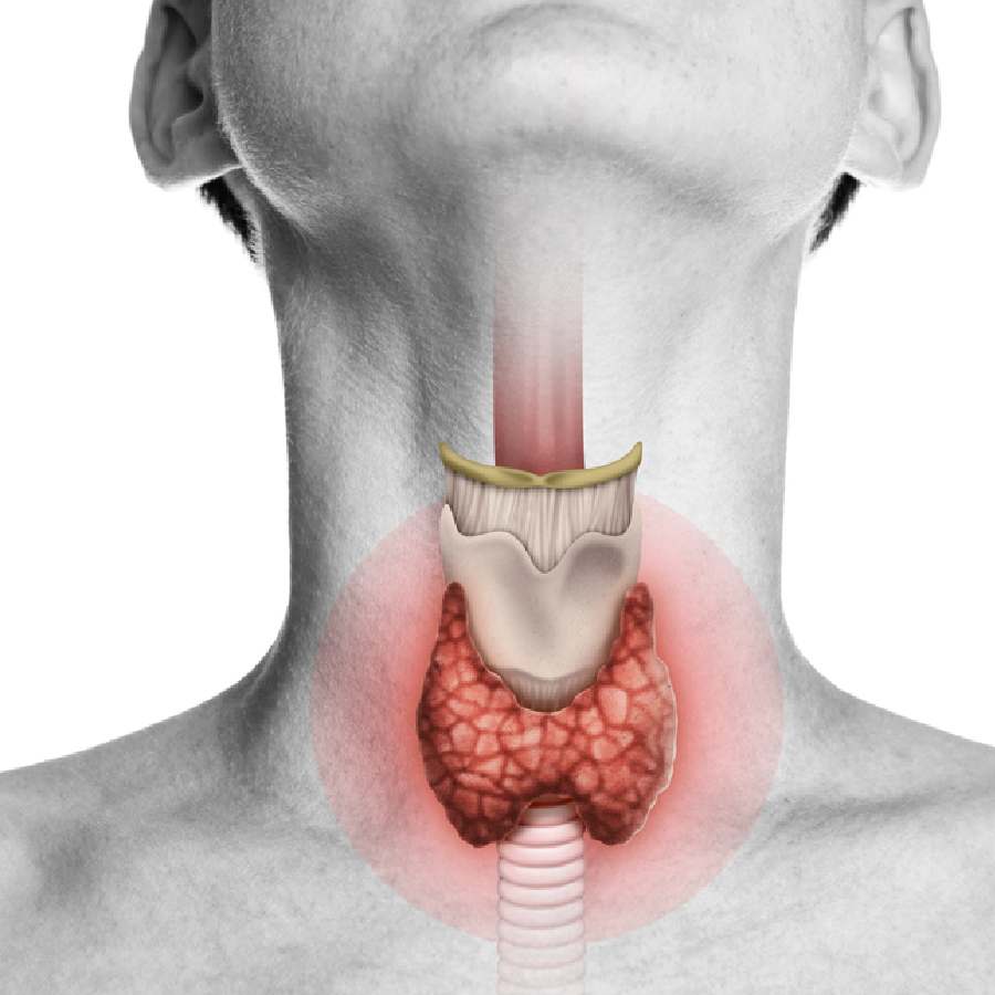 থাইরয়েডের সমস্যা নিয়ন্ত্রণে আনতে হেঁশেলের কোন মশলা কাজে লাগে?