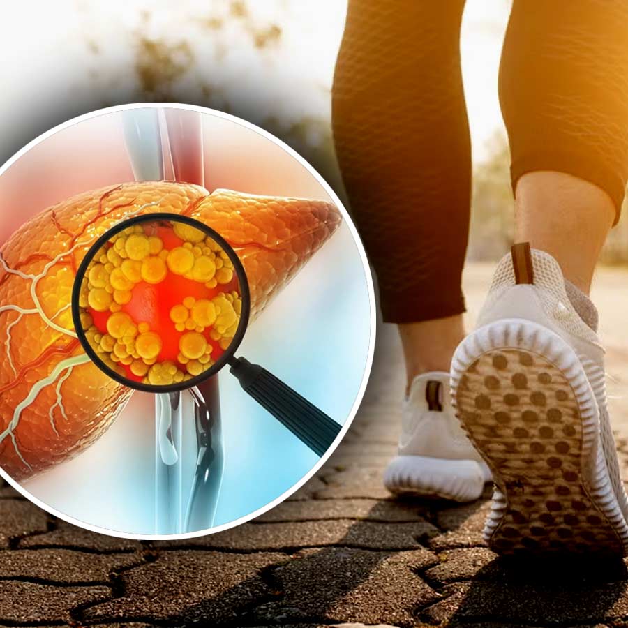 Know how brisk walking helps someone to reduce Fatty Liver problem dgtl