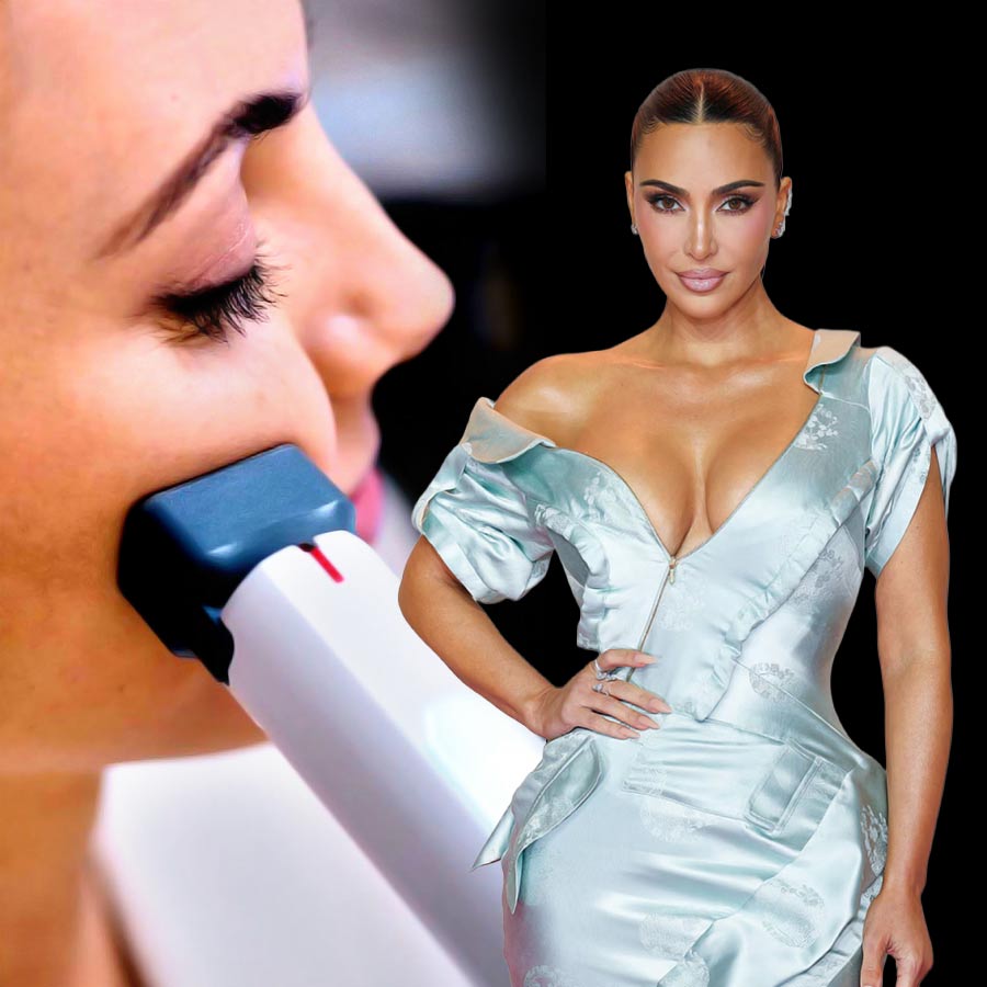 Kim Kardashian getting a skin-tightening treatment called XERF, a radio frequency-based technology
