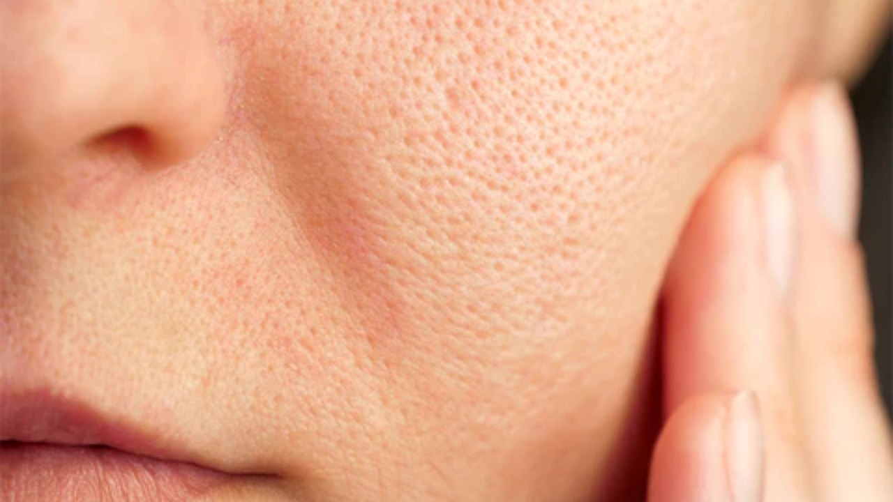 আপনার কি উন্মুক্ত ছিদ্র?