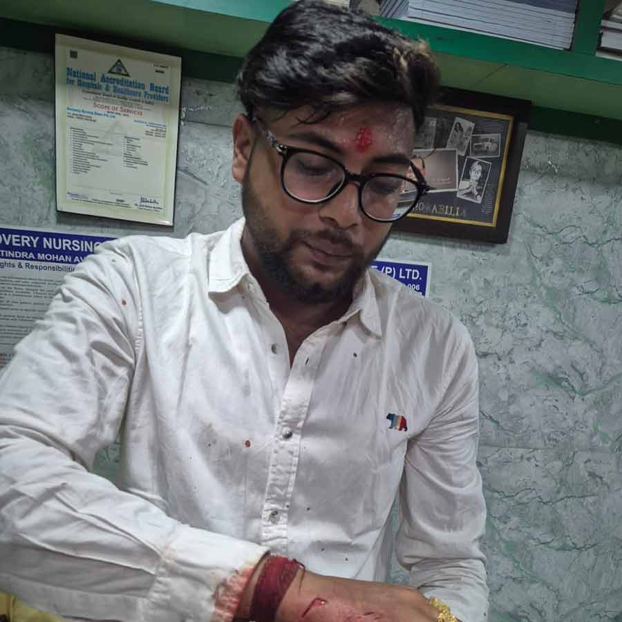 নিজের আঘাত দেখাচ্ছেন বিজেপি কর্মী। 